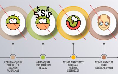tévhitek az implantációval kapcsolatban